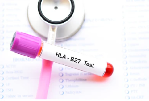 راز ژن‌های HLA در دیابت نوع 1: وقتی سیستم ایمنی علیه خود می‌شود